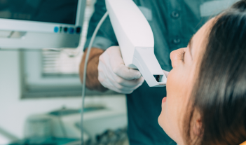 5 Myths About Our Teeth Whitening