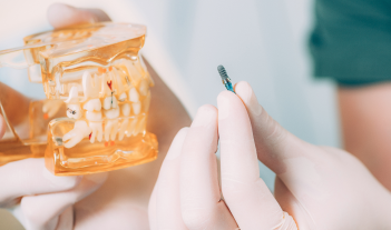 How Gum Disease Cause Heart Attacks